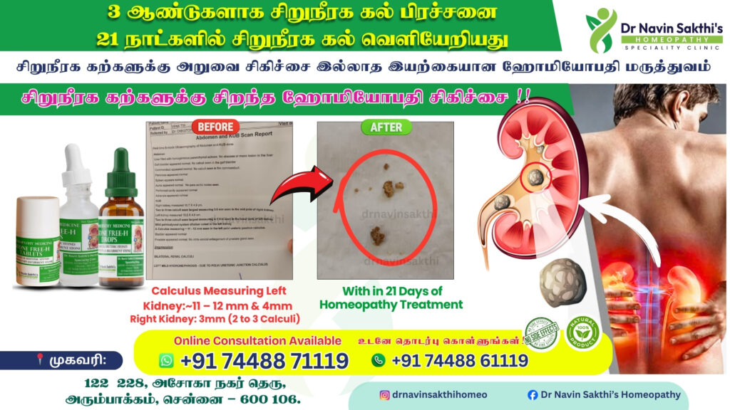 Best kidney stone clinic in Chennai