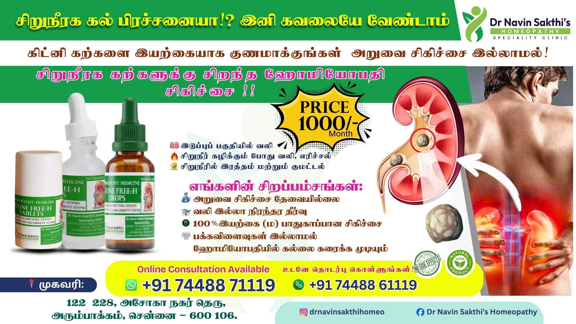 Best Kidney Stone Treatment in Chennai