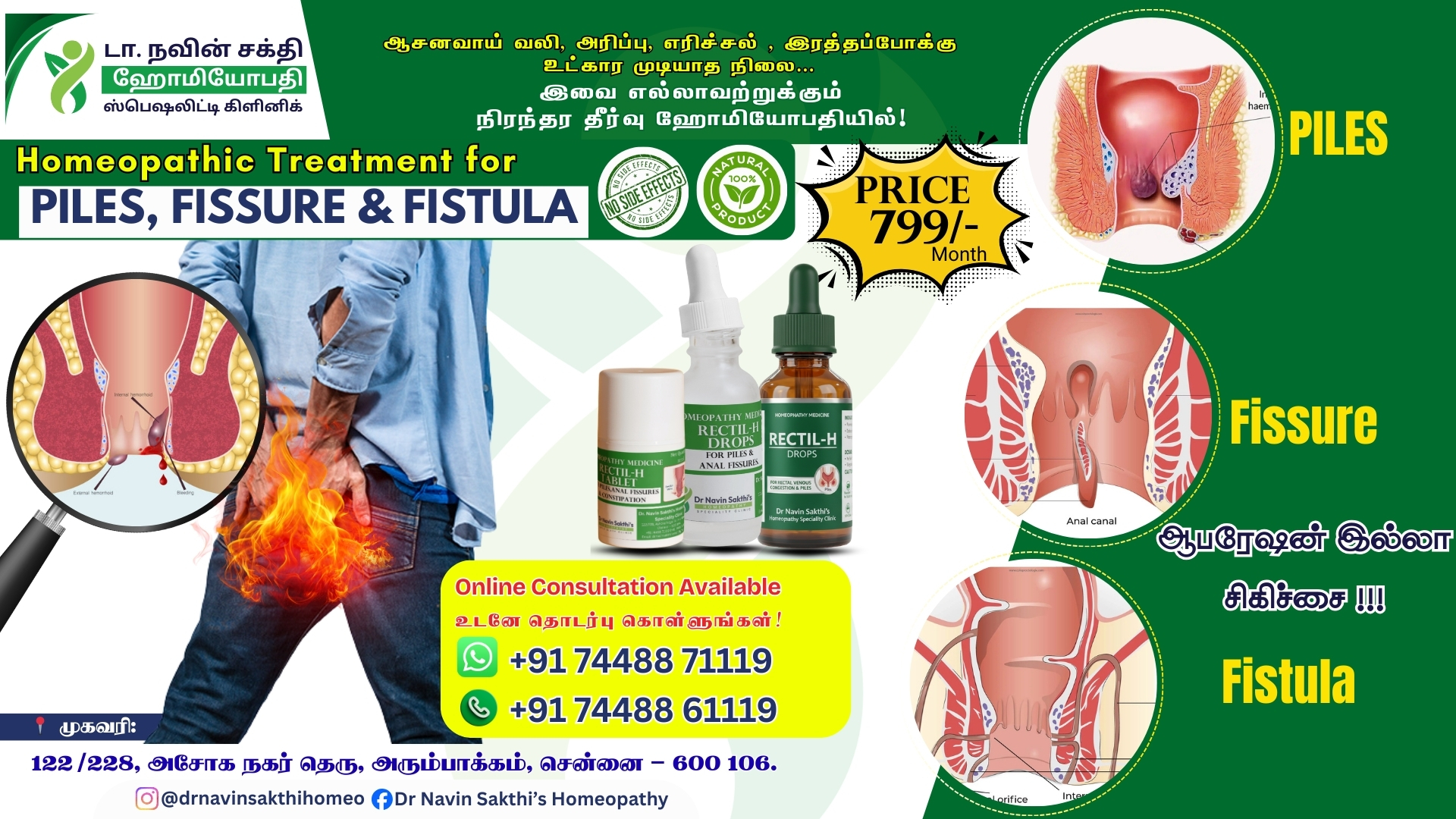 Piles Treatment in Chennai – Best Homeopathy Clinic for piles Treatment