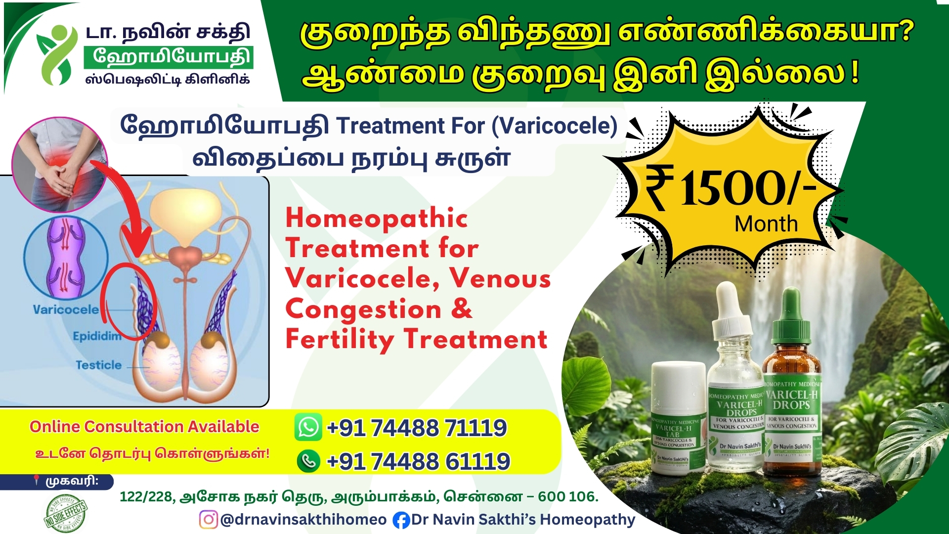 Varicocele Treatment Without Surgery
