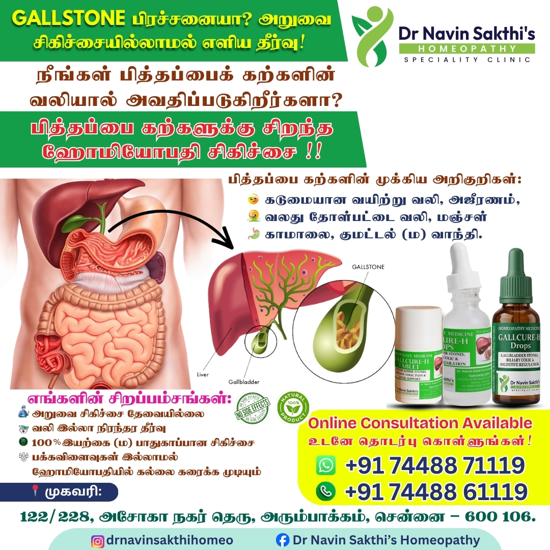 Gallstone homeopathy medicine